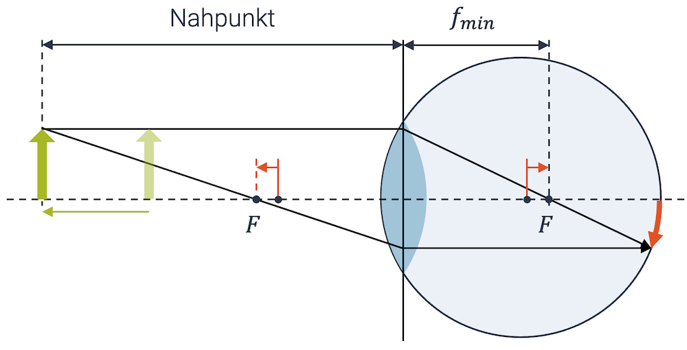 Mit dem mittleren Alter wird die Linse flacher, d.h. die minimale Brennweite grösser, so dass der Nahpunkt (minimale Gegenstandsweite) zunimmt