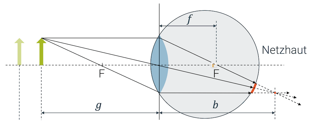 Auge mit falscher Brennweite (unscharfes Bild)